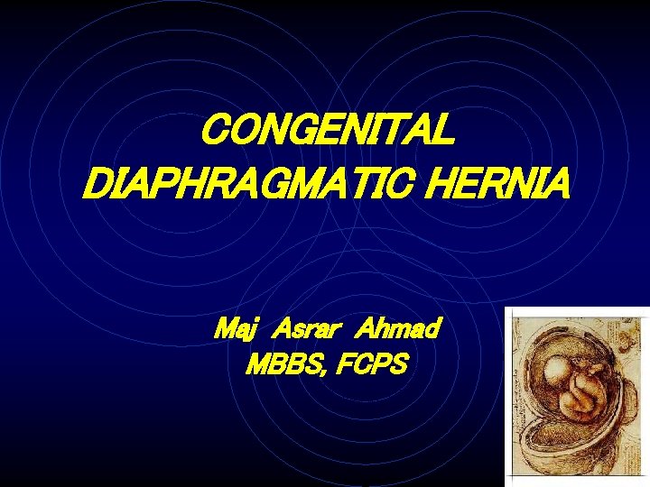 CONGENITAL DIAPHRAGMATIC HERNIA Maj Asrar Ahmad MBBS, FCPS 