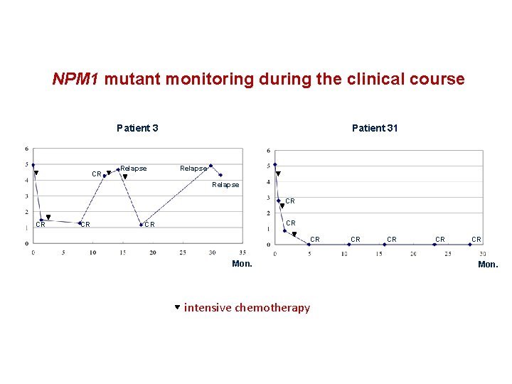 NPM 1 mutant monitoring during the clinical course Patient 3 CR Relapse Patient 31
