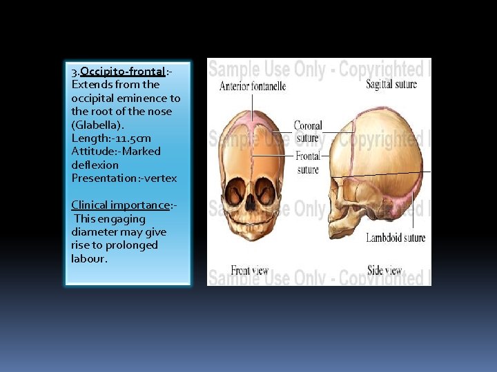 3. Occipito-frontal: Extends from the occipital eminence to the root of the nose (Glabella).