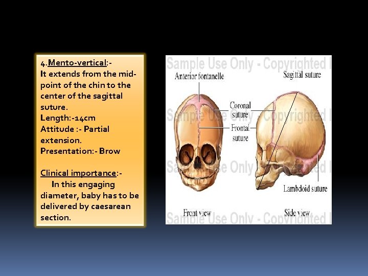 4. Mento-vertical: It extends from the midpoint of the chin to the center of