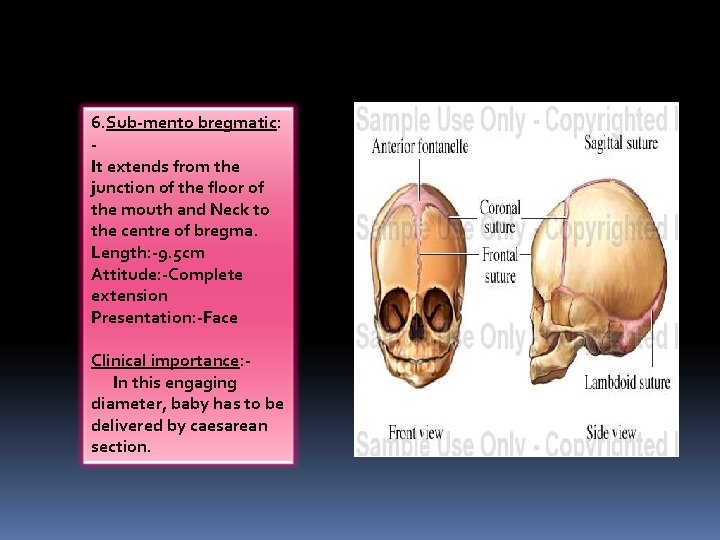 6. Sub-mento bregmatic: It extends from the junction of the floor of the mouth 6. Sub-mento bregmatic: It extends from the junction of the floor of the mouth