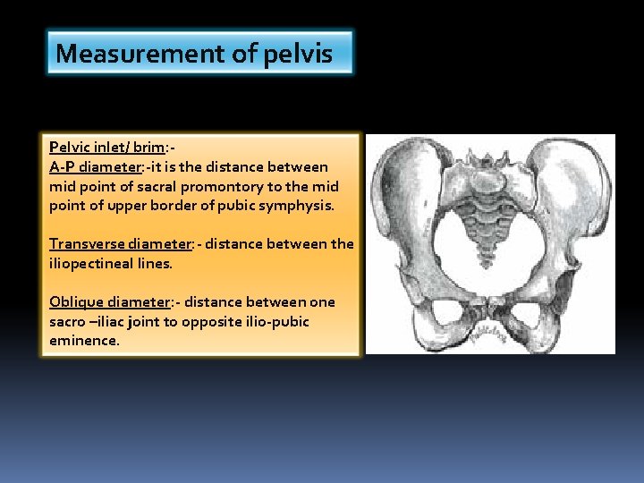 Measurement of pelvis Pelvic inlet/ brim: A-P diameter: -it is the distance between mid