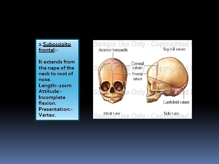 2. Suboccipito frontal: It extends from the nape of the neck to root of