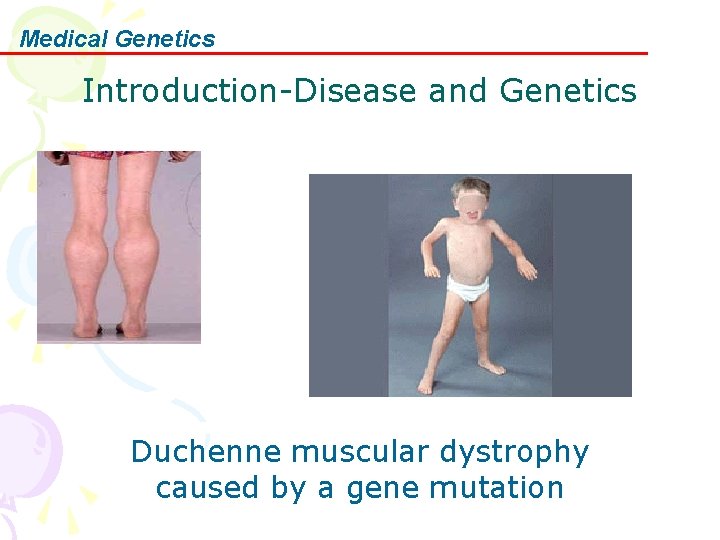 Medical Genetics Introduction-Disease and Genetics Duchenne muscular dystrophy caused by a gene mutation 