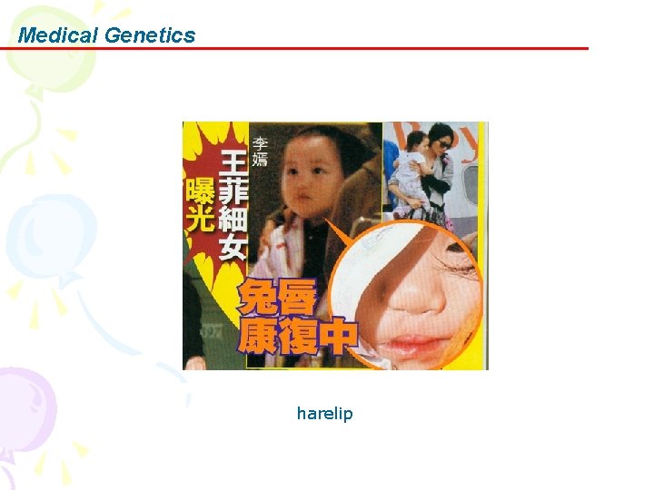 Medical Genetics harelip 