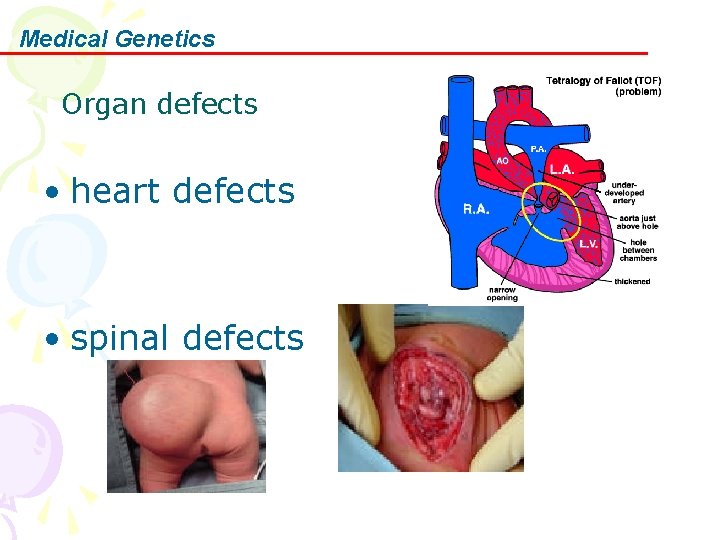 Medical Genetics Organ defects • heart defects • spinal defects 