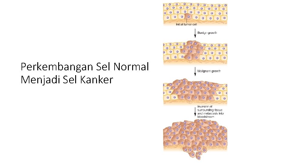 Perkembangan Sel Normal Menjadi Sel Kanker 