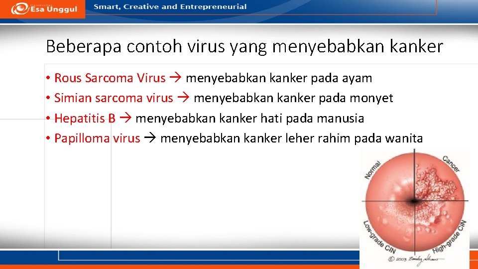 Beberapa contoh virus yang menyebabkan kanker • Rous Sarcoma Virus menyebabkan kanker pada ayam