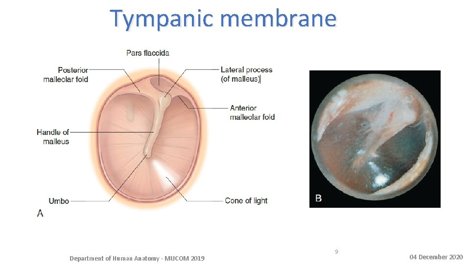 Tympanic membrane Department of Human Anatomy - MUCOM 2019 9 04 December 2020 