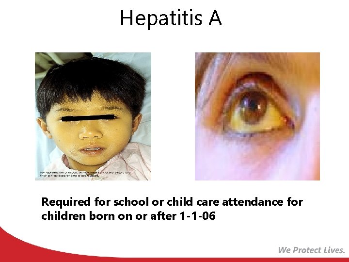 Hepatitis A Required for school or child care attendance for children born on or