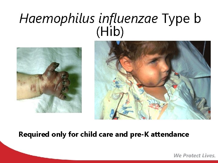 Haemophilus influenzae Type b (Hib) Required only for child care and pre-K attendance 