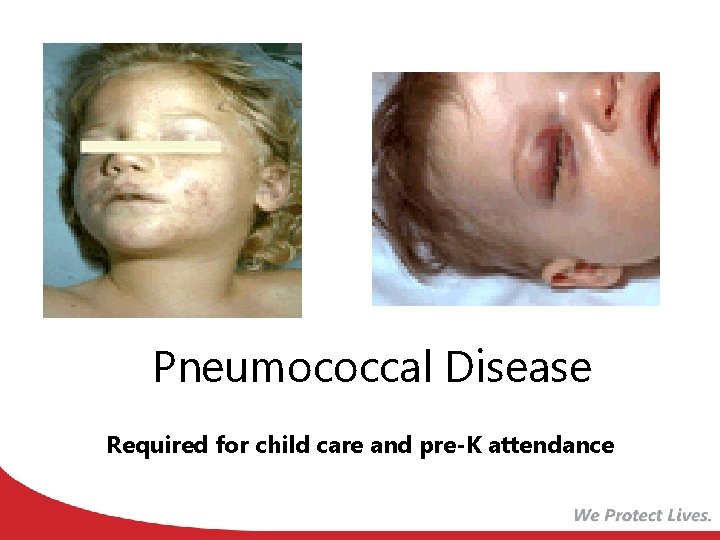 Pneumococcal Disease Required for child care and pre-K attendance 