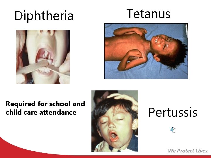 Diphtheria Required for school and child care attendance Tetanus Pertussis 