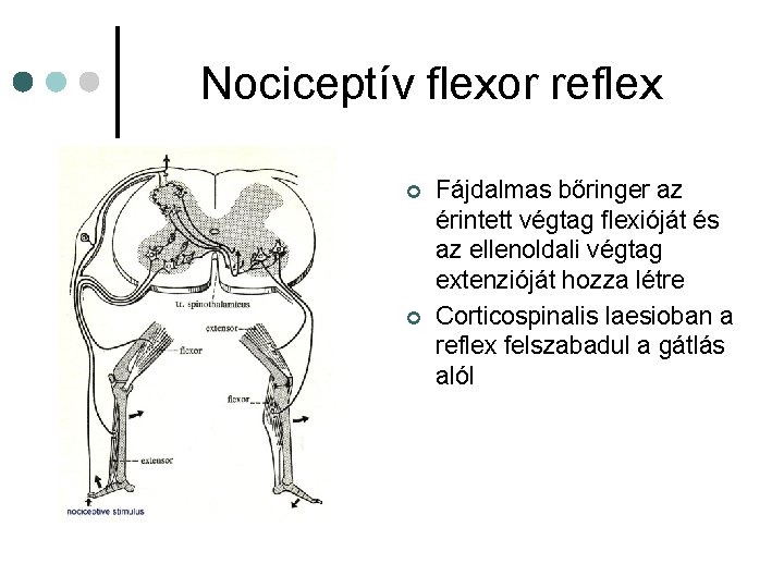 Nociceptív flexor reflex ¢ ¢ Fájdalmas bőringer az érintett végtag flexióját és az ellenoldali Nociceptív flexor reflex ¢ ¢ Fájdalmas bőringer az érintett végtag flexióját és az ellenoldali