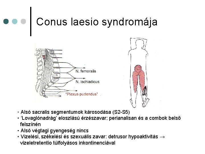 Conus laesio syndromája • Alsó sacralis segmentumok károsodása (S 2 -S 5) • ‘Lovaglónadrág’ Conus laesio syndromája • Alsó sacralis segmentumok károsodása (S 2 -S 5) • ‘Lovaglónadrág’