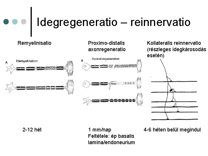 Idegregeneratio – reinnervatio Remyelinisatio 2 -12 hét Proximo-distalis axonregeneratio 1 mm/nap Feltétele: ép basalis Idegregeneratio – reinnervatio Remyelinisatio 2 -12 hét Proximo-distalis axonregeneratio 1 mm/nap Feltétele: ép basalis