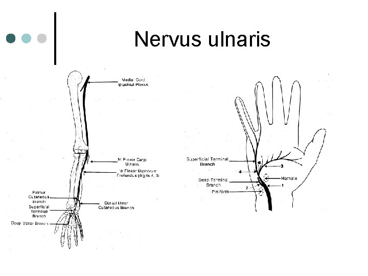 Nervus ulnaris Nervus ulnaris