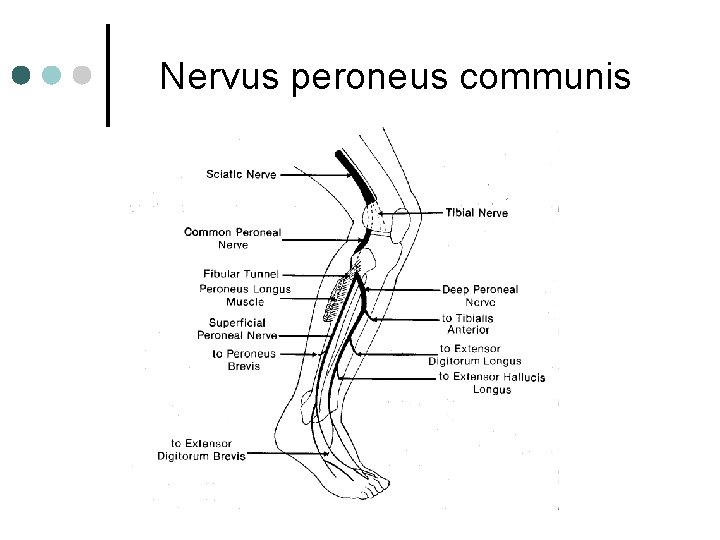 Nervus peroneus communis Nervus peroneus communis