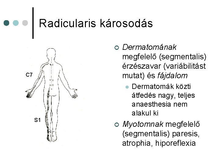 Radicularis károsodás ¢ C 7 Dermatomának megfelelő (segmentalis) érzészavar (variábilitást mutat) és fájdalom l Radicularis károsodás ¢ C 7 Dermatomának megfelelő (segmentalis) érzészavar (variábilitást mutat) és fájdalom l