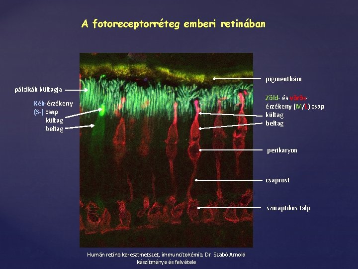 A fotoreceptorréteg emberi retinában pigmenthám pálcikák kültagja Zöld- és vörösérzékeny (M/L) csap kültag beltag