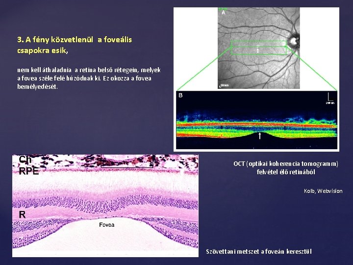 3. A fény közvetlenül a foveális csapokra esik, nem kell áthaladnia a retina belső