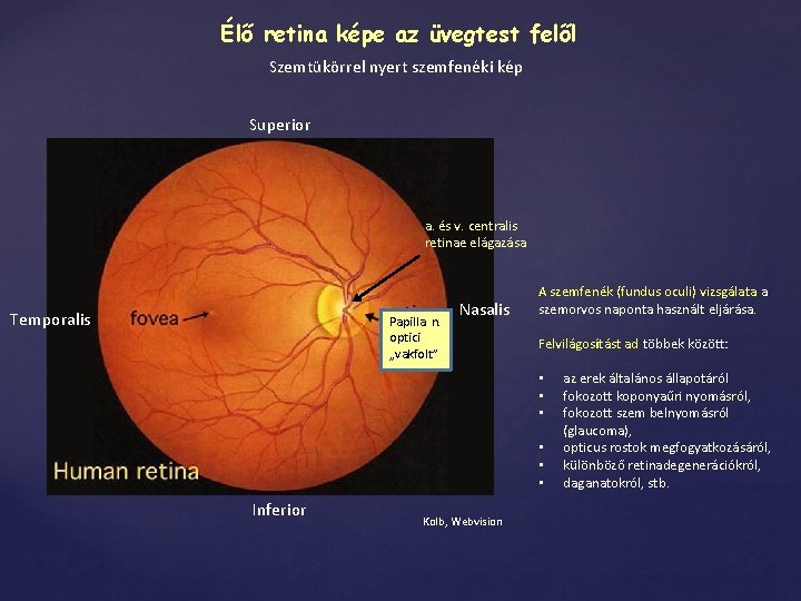 Élő retina képe az üvegtest felől Szemtükörrel nyert szemfenéki kép Superior a. és v.