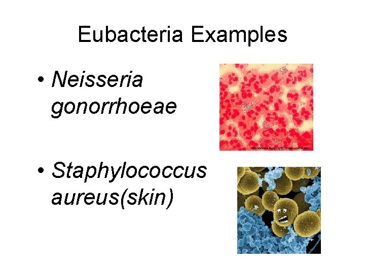 Eubacteria Examples • Neisseria gonorrhoeae • Staphylococcus aureus(skin) 