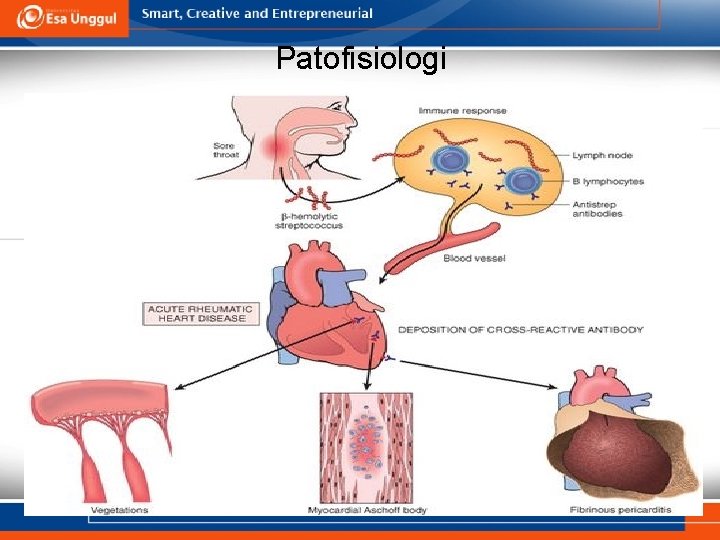 Patofisiologi 