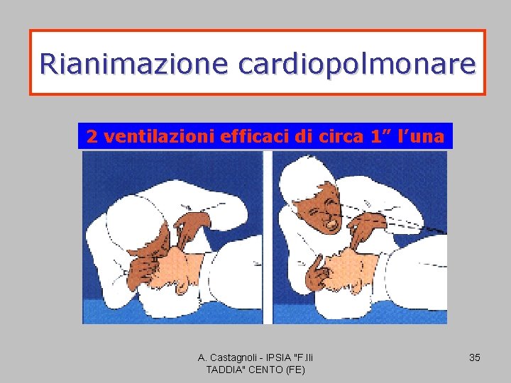 Rianimazione cardiopolmonare 2 ventilazioni efficaci di circa 1” l’una A. Castagnoli - IPSIA "F.