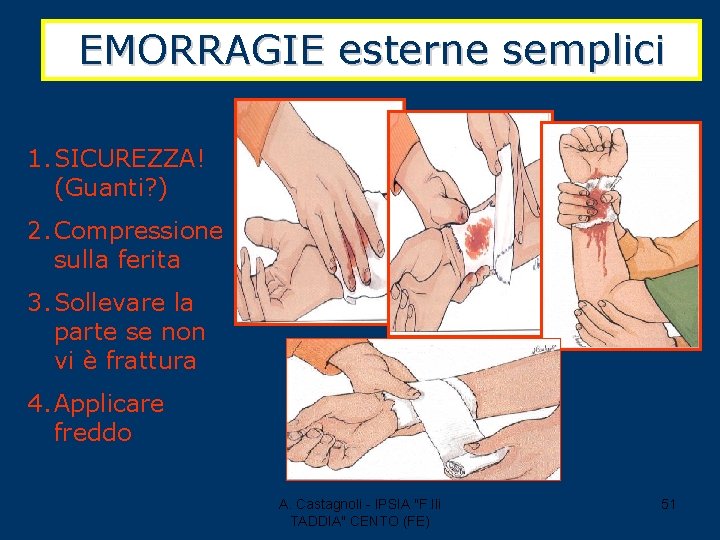 EMORRAGIE esterne semplici 1. SICUREZZA! (Guanti? ) 2. Compressione sulla ferita 3. Sollevare la