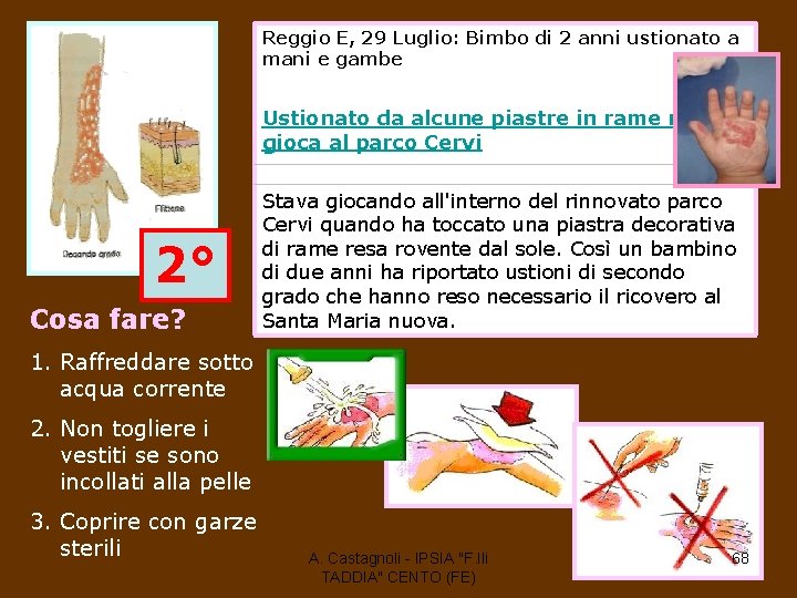 Reggio E, 29 Luglio: Bimbo di 2 anni ustionato a mani e gambe Ustionato