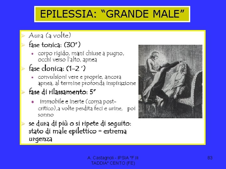 EPILESSIA: “GRANDE MALE” A. Castagnoli - IPSIA "F. lli TADDIA" CENTO (FE) 83 