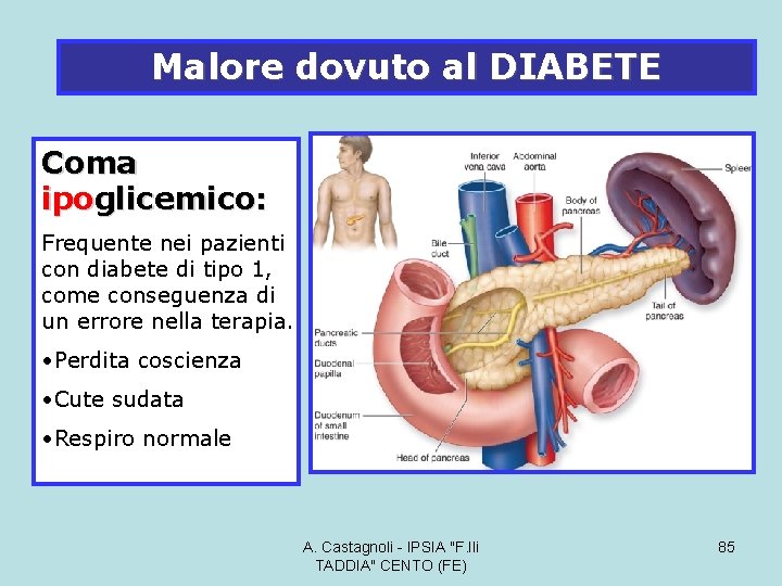 Malore dovuto al DIABETE Coma ipoglicemico: Frequente nei pazienti con diabete di tipo 1,
