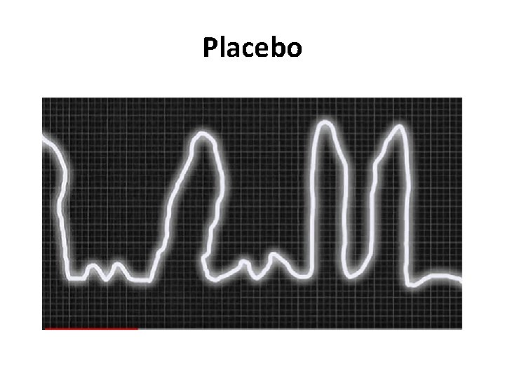Placebo 