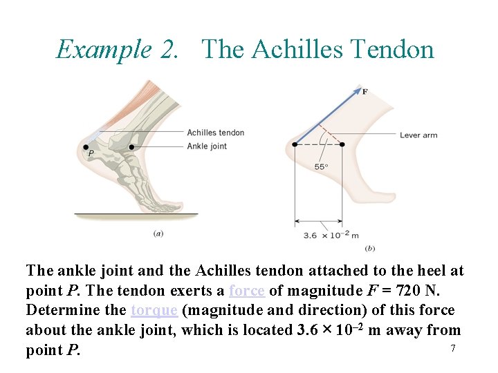 Example 2. The Achilles Tendon The ankle joint and the Achilles tendon attached to