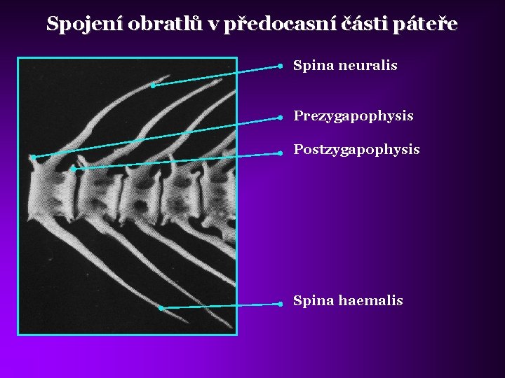 Spojení obratlů v předocasní části páteře Spina neuralis Prezygapophysis Postzygapophysis Spina haemalis 