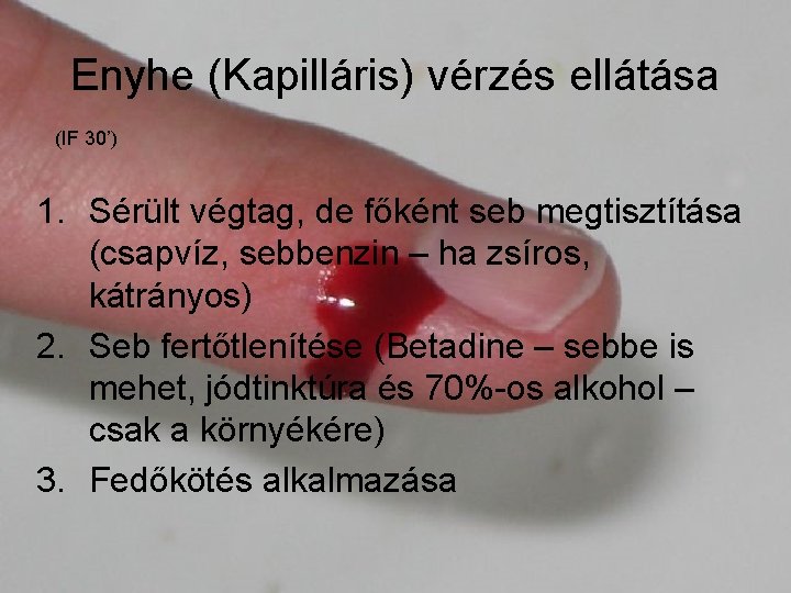 Enyhe (Kapilláris) vérzés ellátása (IF 30’) 1. Sérült végtag, de főként seb megtisztítása (csapvíz,