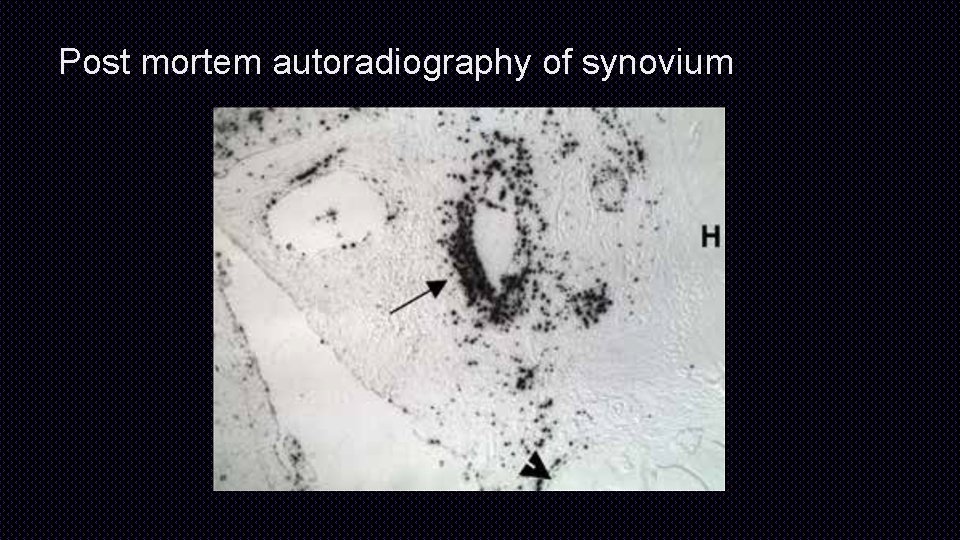 Post mortem autoradiography of synovium 