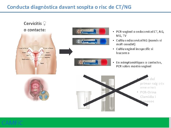 Conducta diagnòstica davant sospita o risc de CT/NG Cervicitis ♀ o contacte: • PCR-vaginal