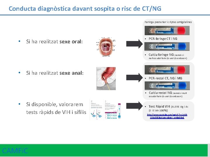 Conducta diagnòstica davant sospita o risc de CT/NG Faringe posterior i criptes amigdalines •