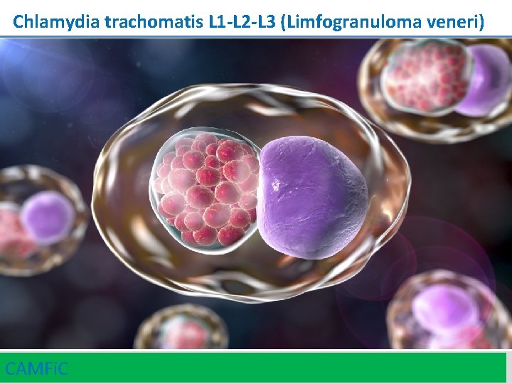 Chlamydia trachomatis L 1 -L 2 -L 3 (Limfogranuloma veneri) CAMFi. C 39 