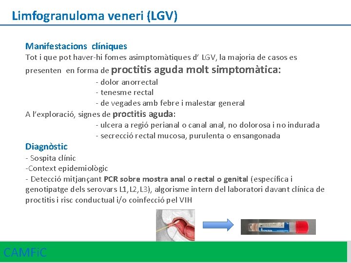 Limfogranuloma veneri (LGV) Manifestacions clíniques Tot i que pot haver-hi fomes asimptomàtiques d’ LGV,