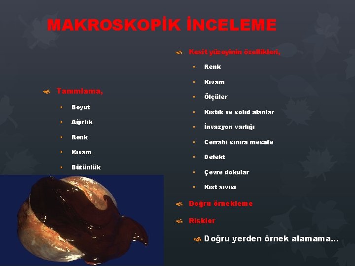 MAKROSKOPİK İNCELEME Tanımlama, • Boyut • Ağırlık • Renk • Kıvam • Bütünlük Kesit MAKROSKOPİK İNCELEME Tanımlama, • Boyut • Ağırlık • Renk • Kıvam • Bütünlük Kesit