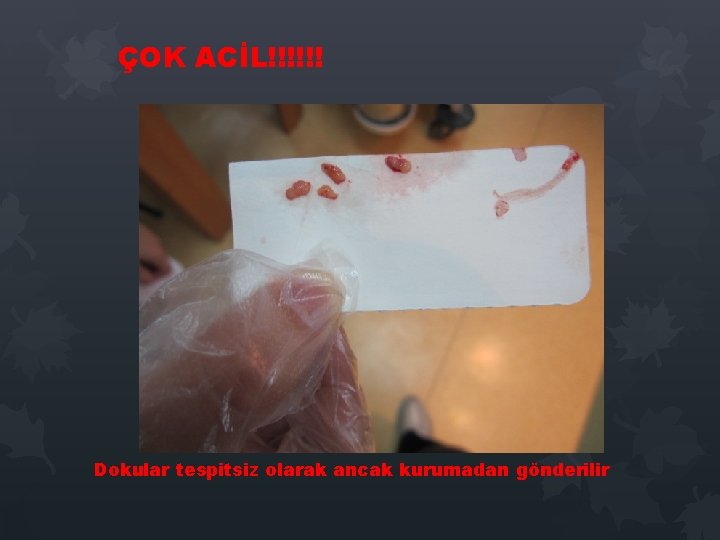 ÇOK ACİL!!!!!! Dokular tespitsiz olarak ancak kurumadan gönderilir ÇOK ACİL!!!!!! Dokular tespitsiz olarak ancak kurumadan gönderilir