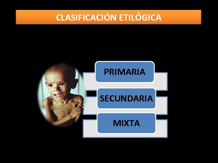 CLASIFICACIÓN ETILÓGICA PRIMARIA SECUNDARIA MIXTA 