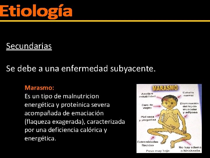 Secundarias Se debe a una enfermedad subyacente. Marasmo: Es un tipo de malnutricion energética
