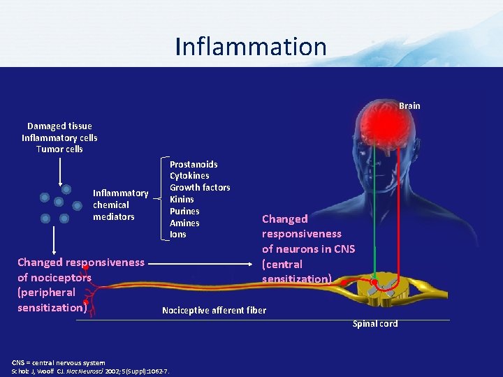 Inflammation Brain Damaged tissue Inflammatory cells Tumor cells Inflammatory chemical mediators Changed responsiveness of