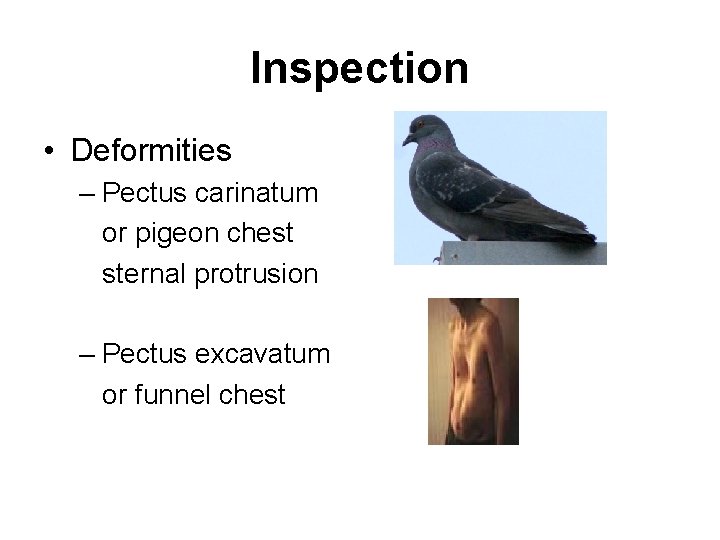 Inspection • Deformities – Pectus carinatum or pigeon chest sternal protrusion – Pectus excavatum