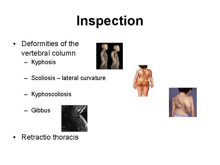 Inspection • Deformities of the vertebral column – Kyphosis – Scoliosis – lateral curvature