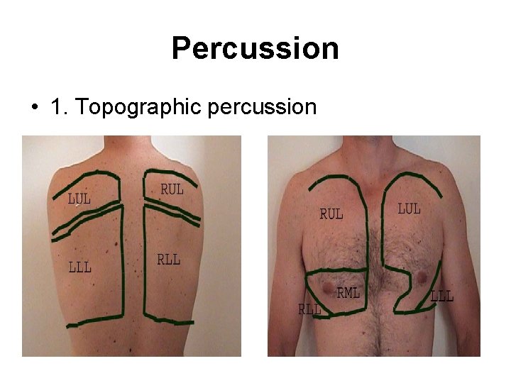 Percussion • 1. Topographic percussion 